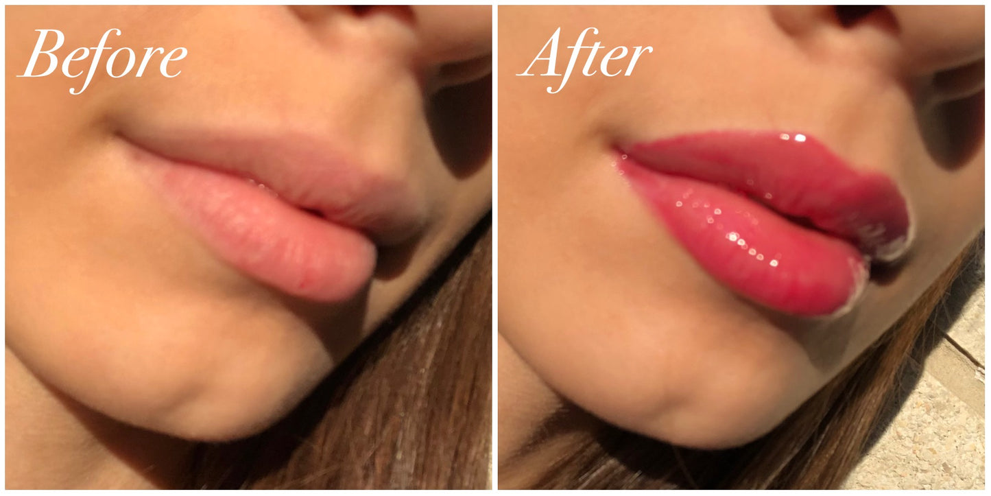 Mil Rosas - Lip Plumper